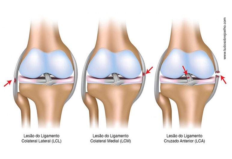 Ligamentos do Joelho